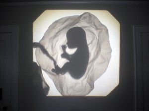 Josiane Keller - embryo in womb