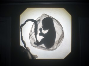 Josiane Keller - fetus in womb test pic oh