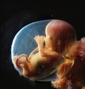 Lennart Nilsson - human fetus 8th week